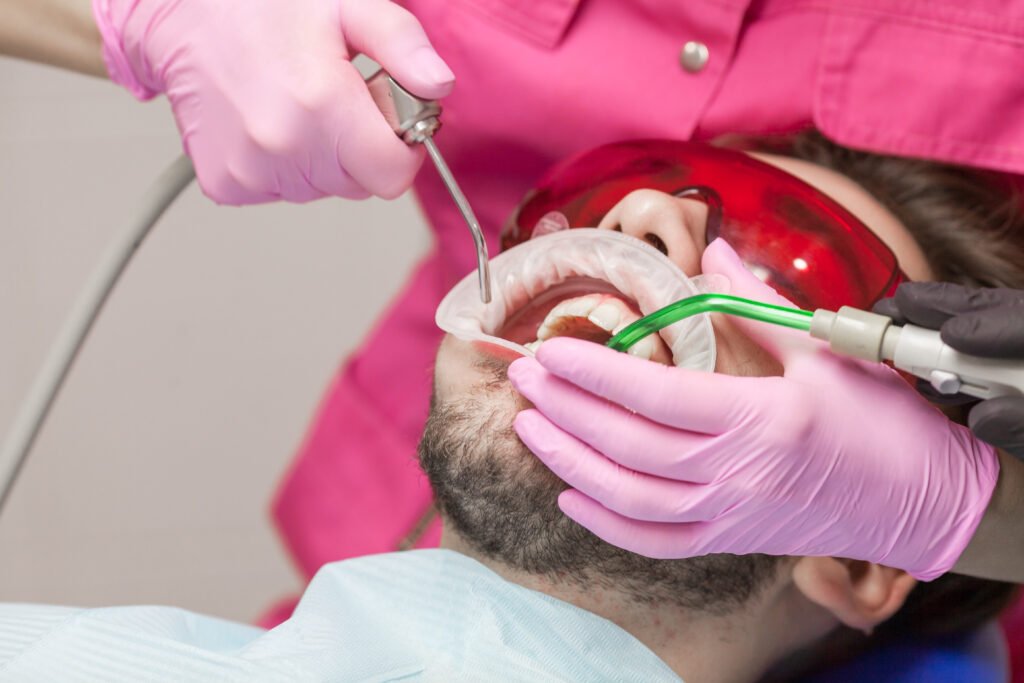 limpieza dental en tijuana