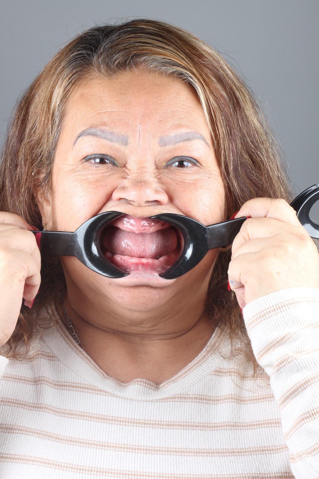 Paciente Comfortdent Experts 09 anes