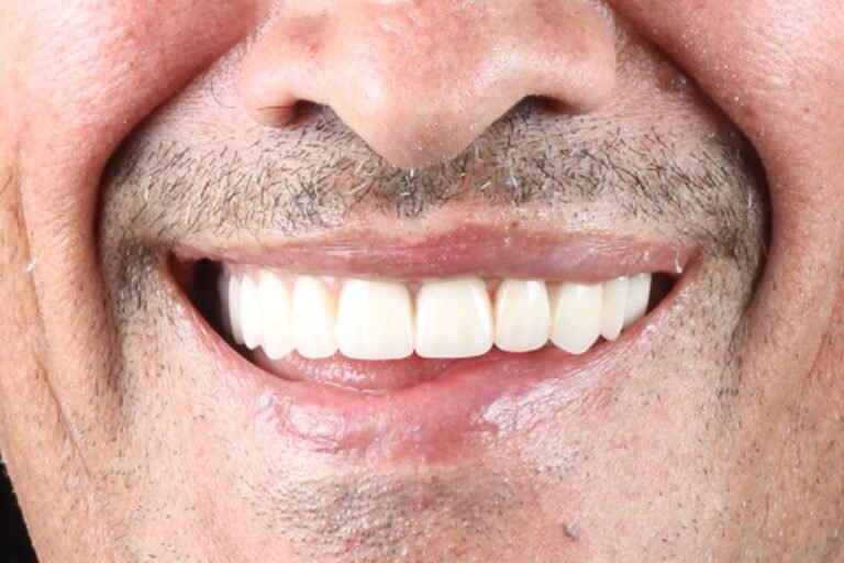 Paciente-Comfortdent-Experts-10-despues2