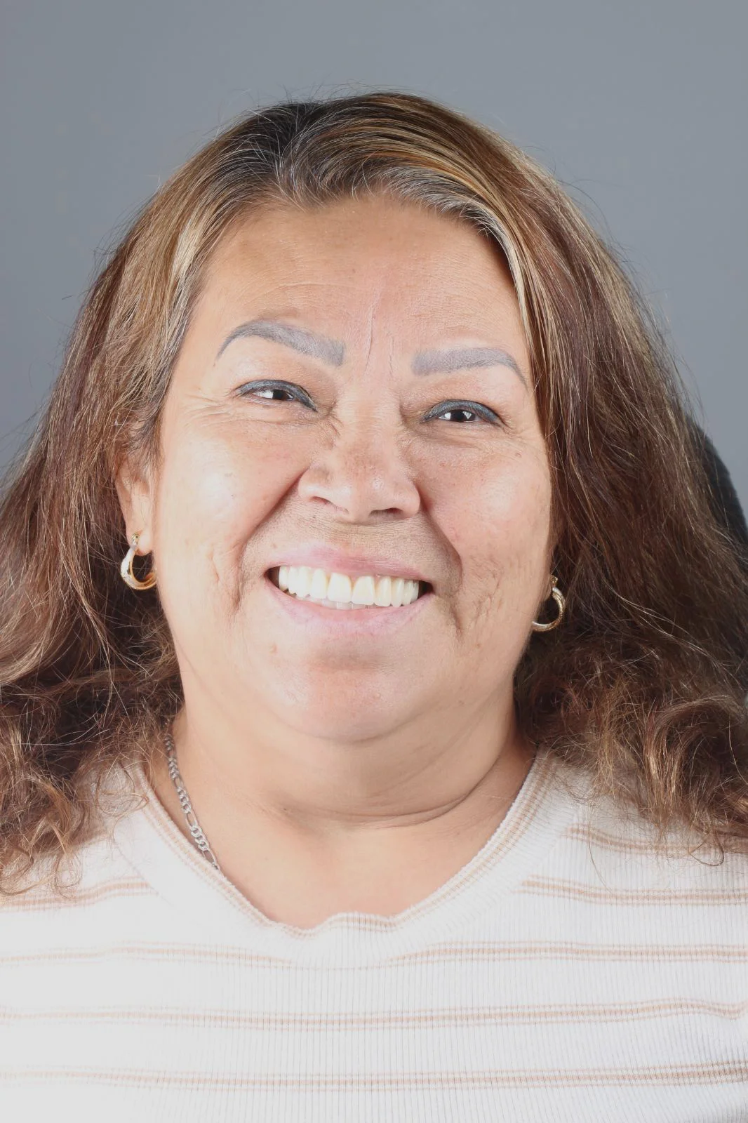 Implantes dentales en Tijuana