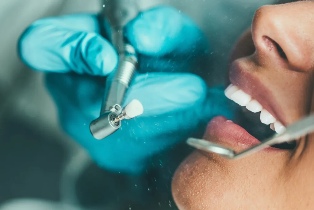limpieza dental en tijuana