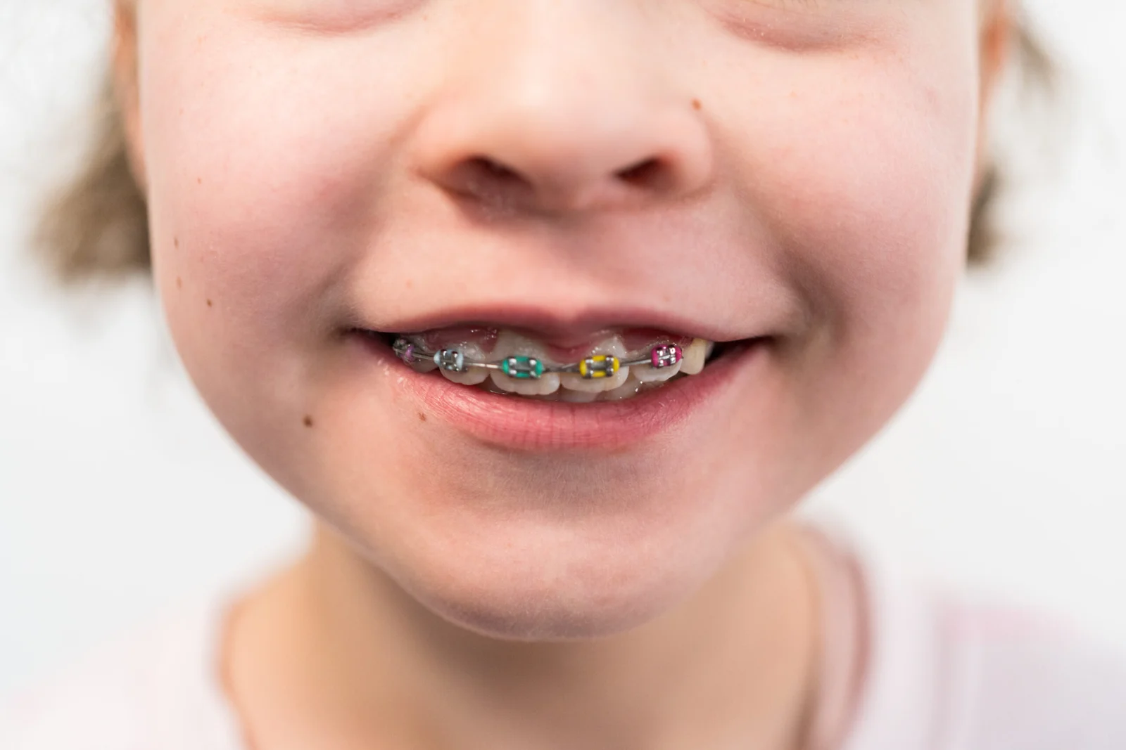 odontopediatria