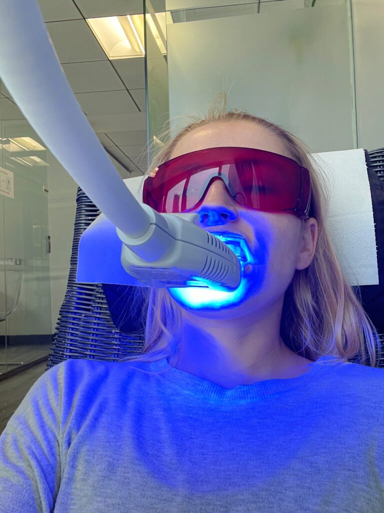 blanqueamiente dental en tijuana